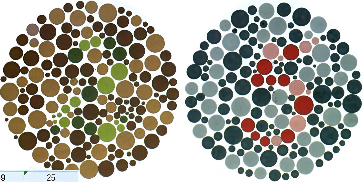 色弱最新測(cè)試圖及答案,色弱最新測(cè)試圖及答案解析